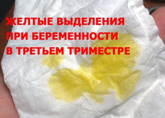 Выделения при беременности во втором триместре: какие должны быть?