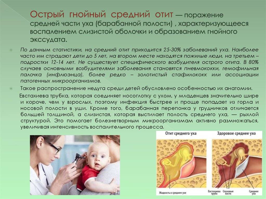Как правильно лечить катаральный отит у детей: эффективные методы
