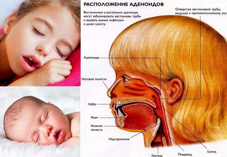 Заложен нос у ребенка без соплей: как быстро и эффективно лечить?