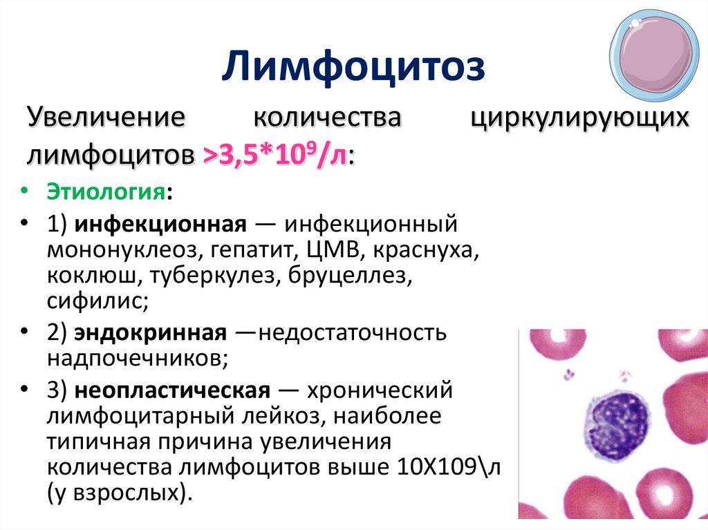 Повышенный уровень лейкоцитов в крови ребенка: причины лейкоцитоза, последствия и лечение
