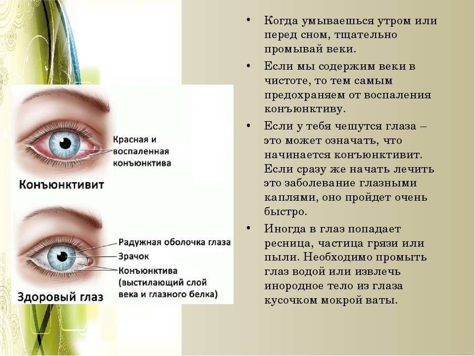 Воспаление глаза у ребенка - детский конъюнктивит