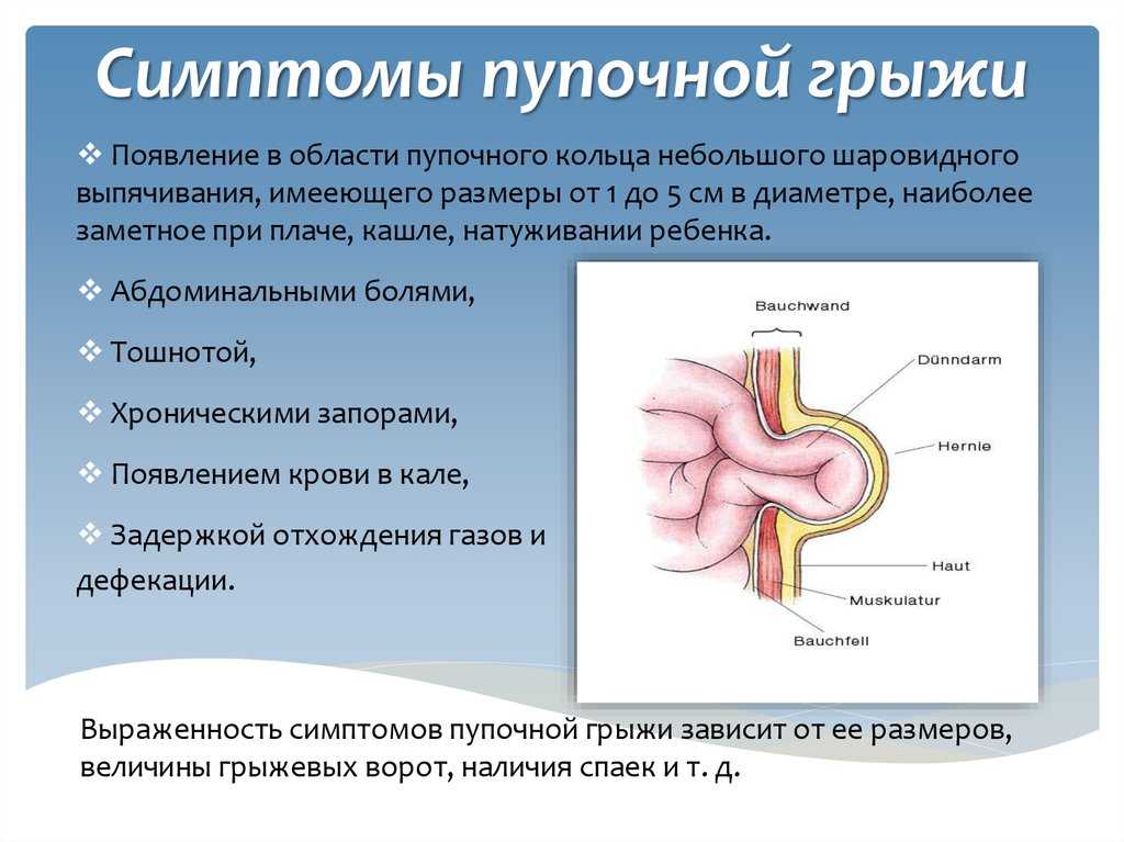 Паховая грыжа у грудничков: причины образования патологии у новорожденных, симптомы у мальчиков и девочек, лечение