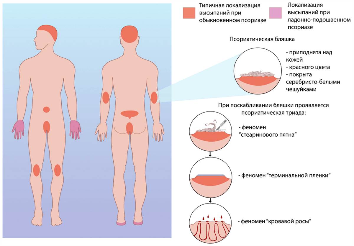 Разновидности дерматитов у детей: фото симптомов и виды лечения | beauty-line14a.ru