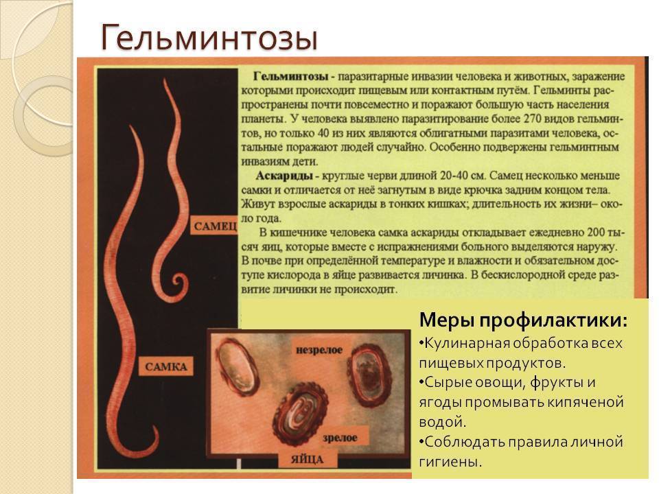 8 состояний, под которые «маскируется» аскаридоз у детей