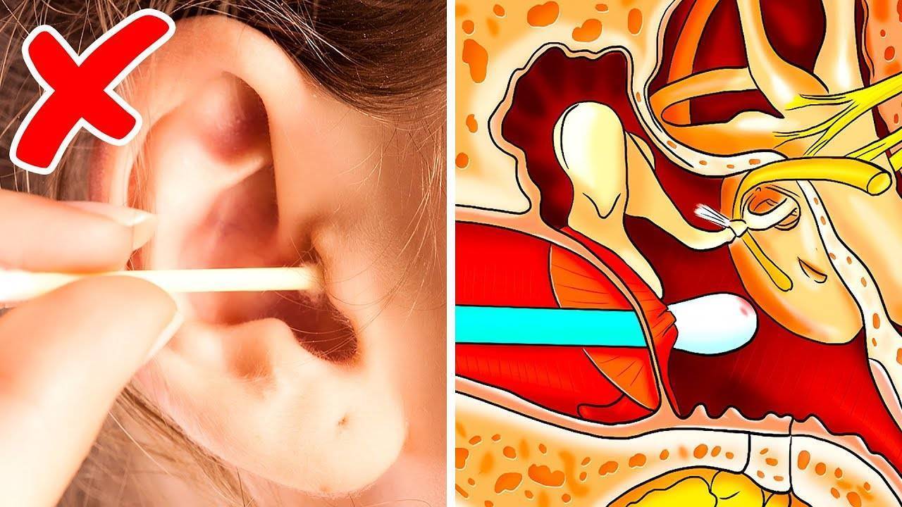 Кровь из ушей: причины, симптомы и первая помощь