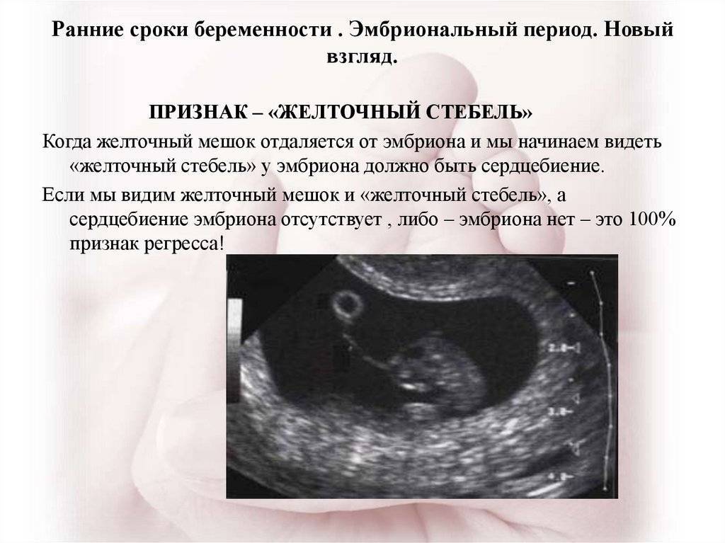 Замершая беременность: признаки, причины на ранних сроках