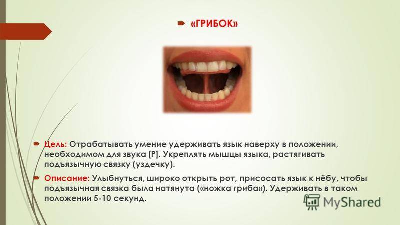 Короткая уздечка языка или верхней губы у ребенка: в каком возрасте подрезать и надо ли это делать?