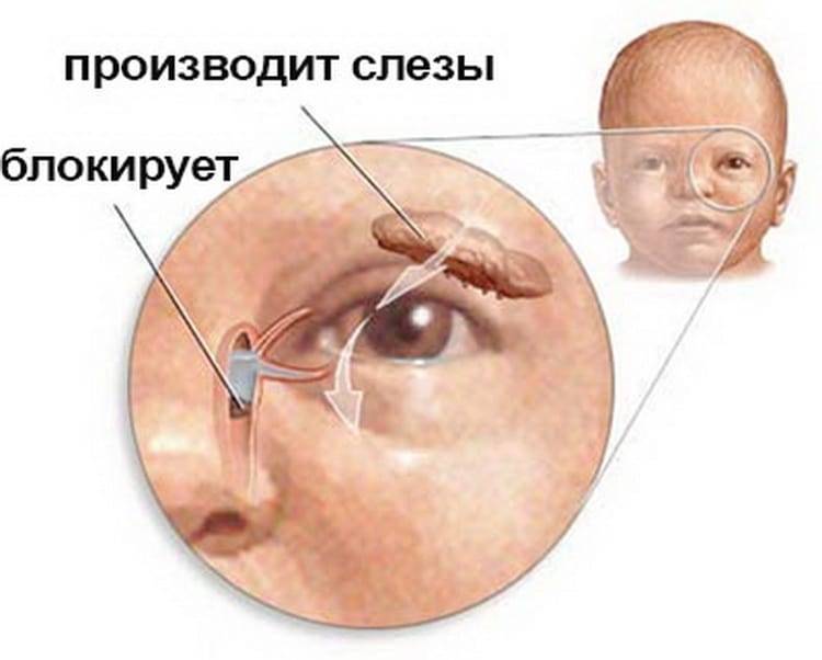 Закисают глаза у ребенка: причины, лечение для младенцев и детей после года