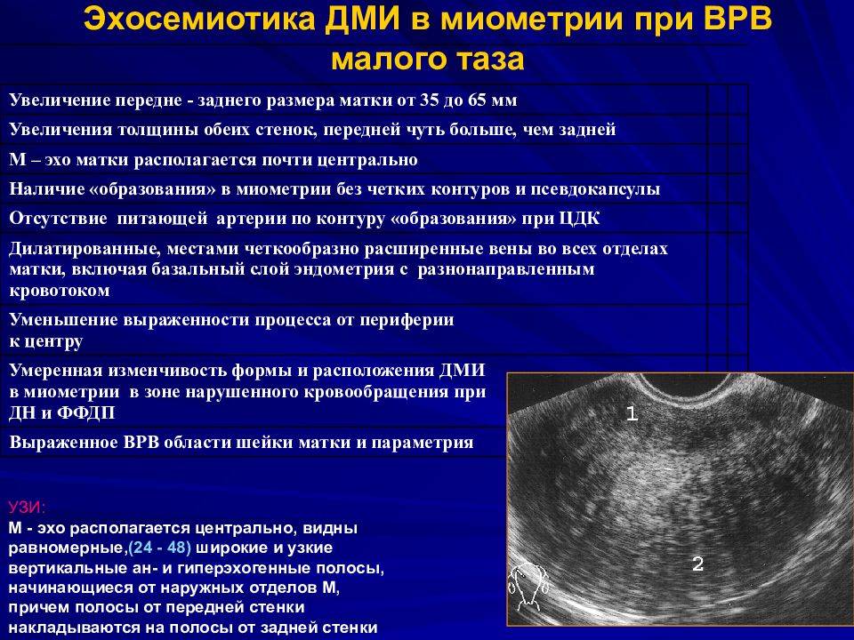Гипертонус матки при беременности: чем опасен, причины, лечение / mama66.ru