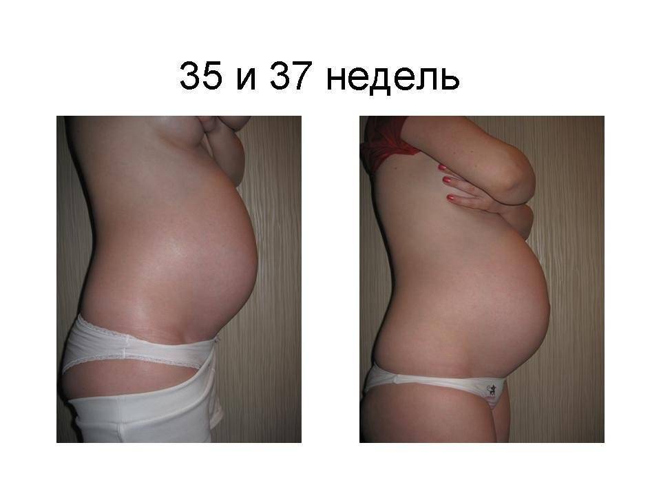 Когда опускается живот у первородящих и повторнородящих?