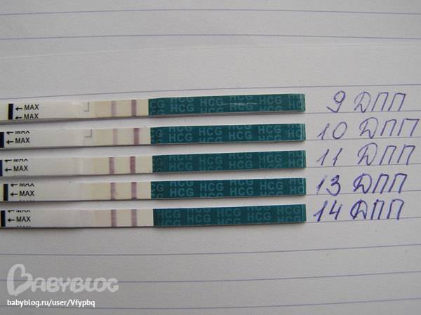 После эко тянет поясницу: болит спина на 8-11 и 4-5 дпп