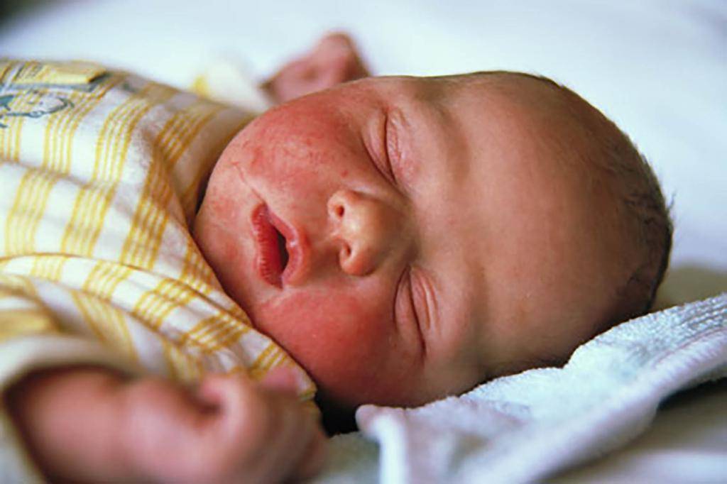 Золотистый стафилококк в кале у ребенка: опасность и лечение инфекции