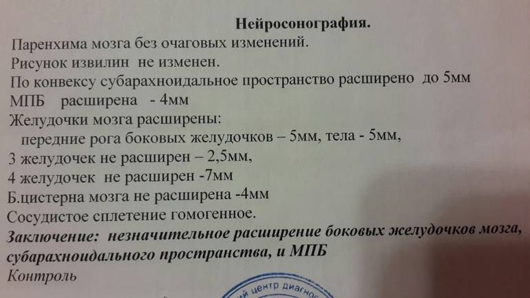Нейросонография новорожденных: когда назначают, что показывает, расшифровка и нормы - сайт о