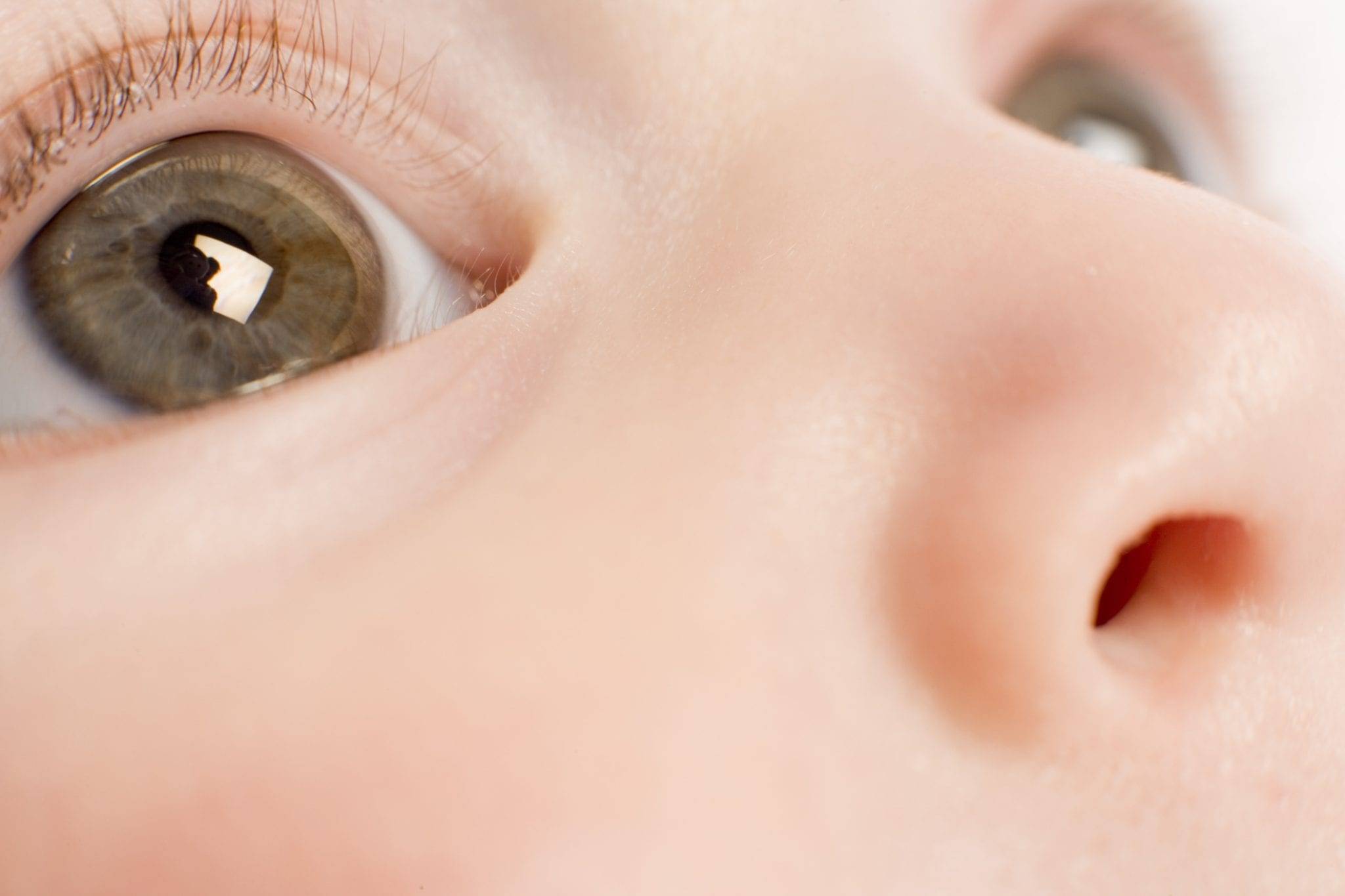У новорожденного закисает глазик: что делать и как лечить (капли, народные средства, массаж), рекомендации комаровского, причины
