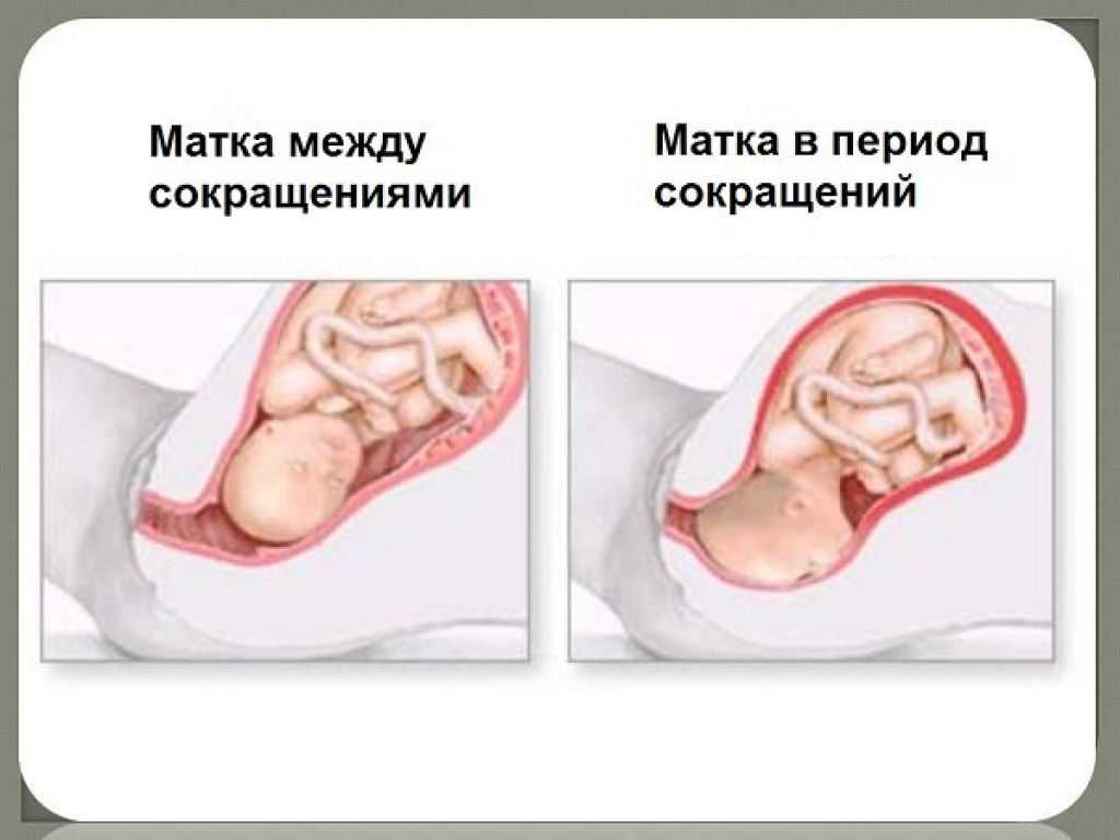 Запор на поздних сроках беременности - myzapor - лечение запоров у детей и взрослых, лекарства и народные способы