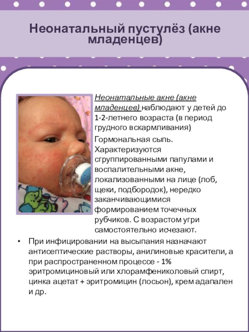 Герпес у грудничка - симптомы и эффективное лечение