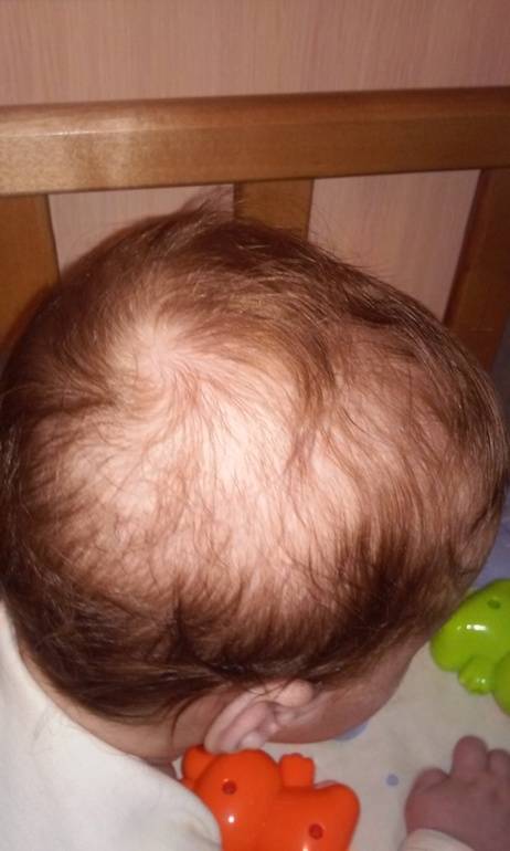 Что делать, если у малыша плохо растут волосы?
