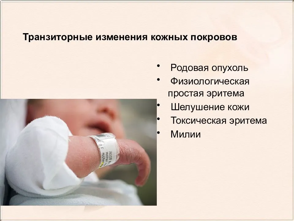 Токсическая эритема у новорожденных: что это такое, причины появления, как лечится | mfarma.ru