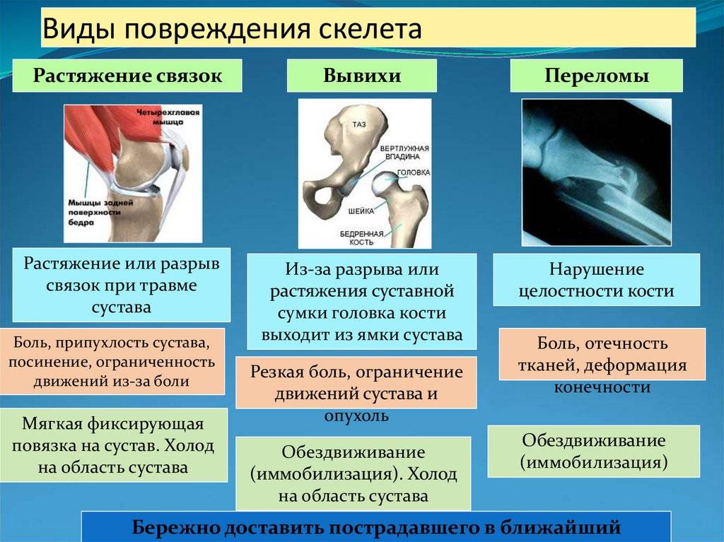 Переломы руки у ребенка со смещением и без: симптомы травмы лучевой и локтевой костей и предплечья, лечение, повязки