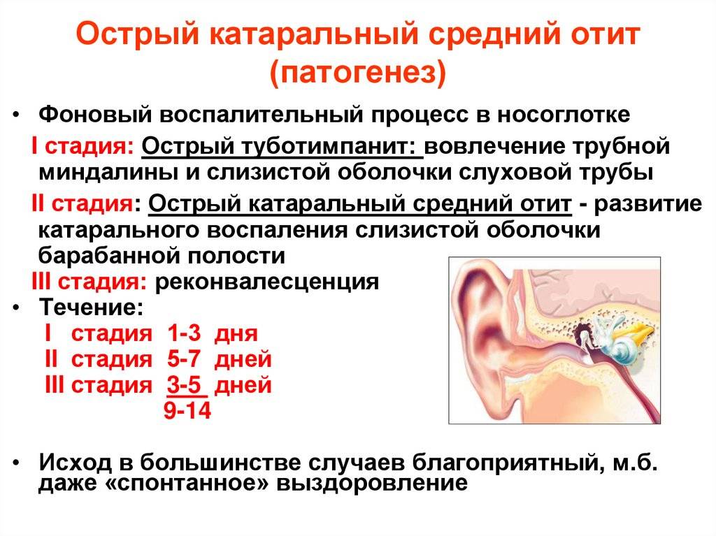 Экссудативный средний отит. руководство для родителей и не только. - лор кулешов богдан юрьевич