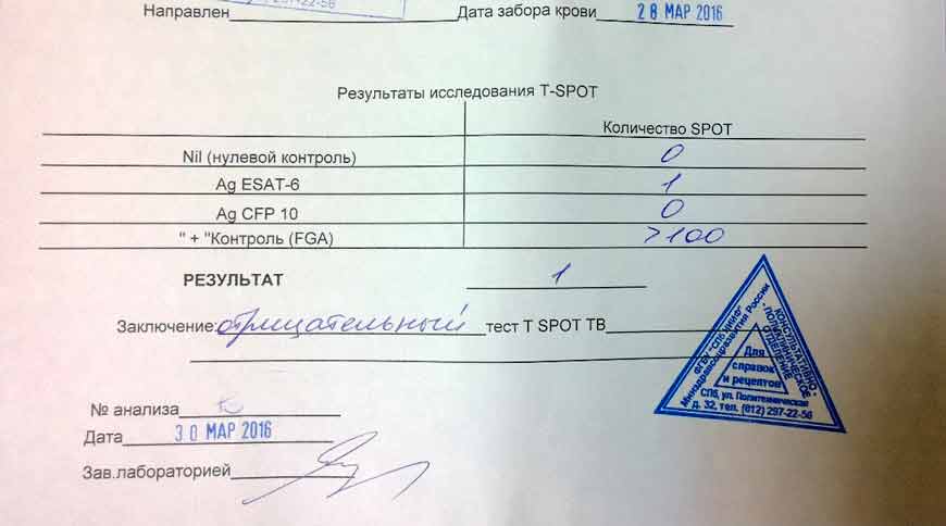 Альтернативы манту для ребенка по закону: анализ крови, мочи и другие способы проверки вместо пробы на туберкулез