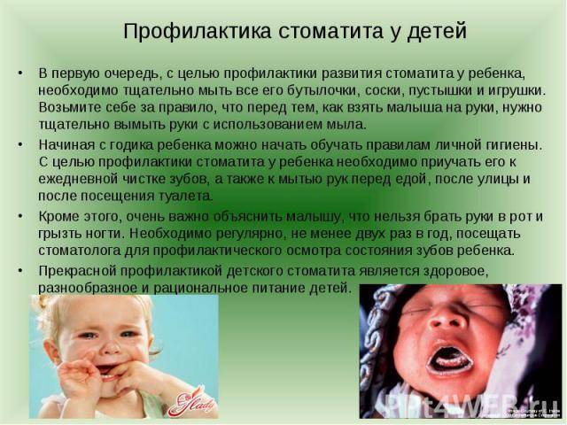 Стоматит у детей: симптомы и лечение, причины и виды | семейный доктор