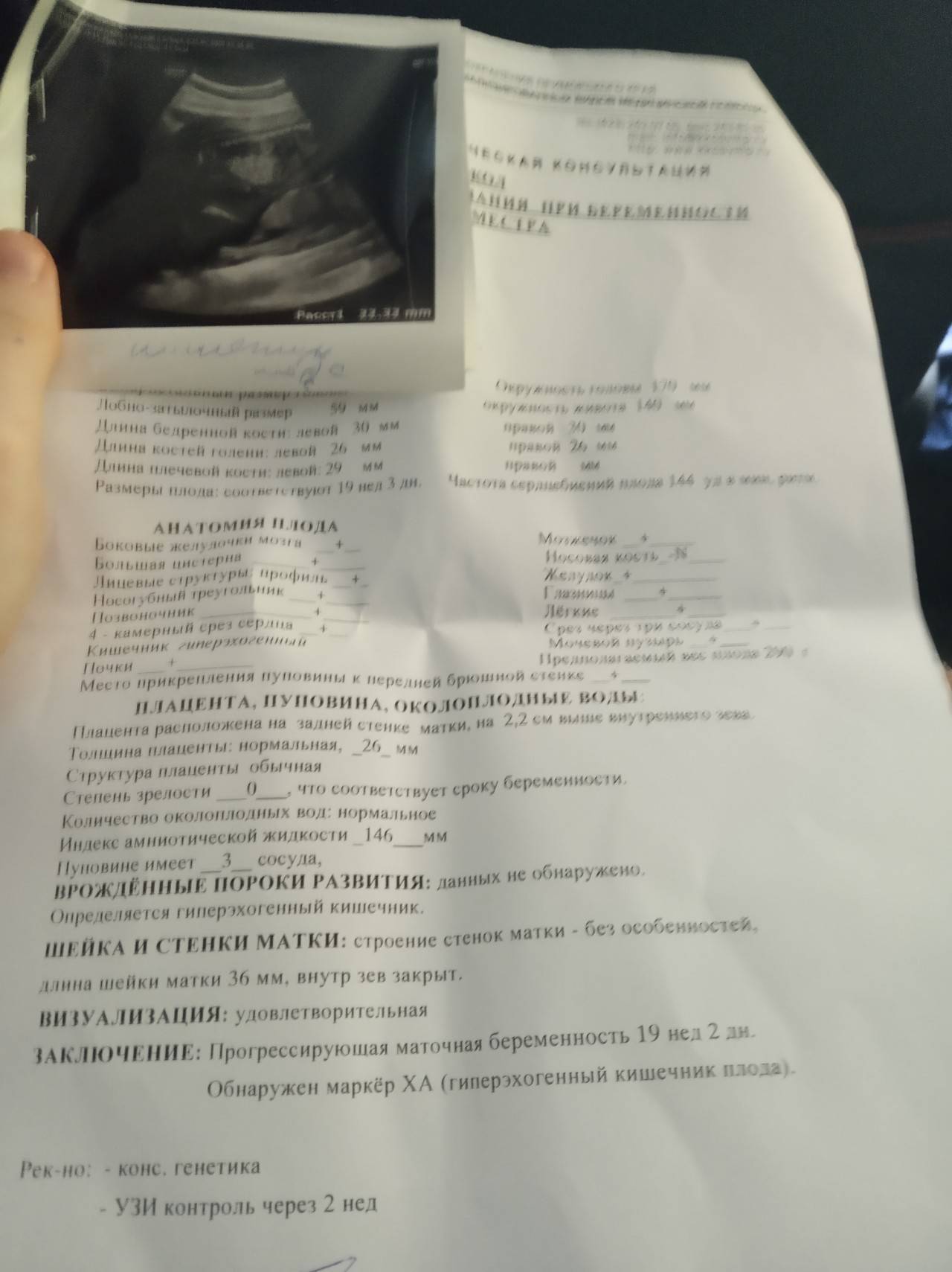 Аномалии и патологии органов пищеварительной системы плода, выявляемые на узи * клиника диана в санкт-петербурге