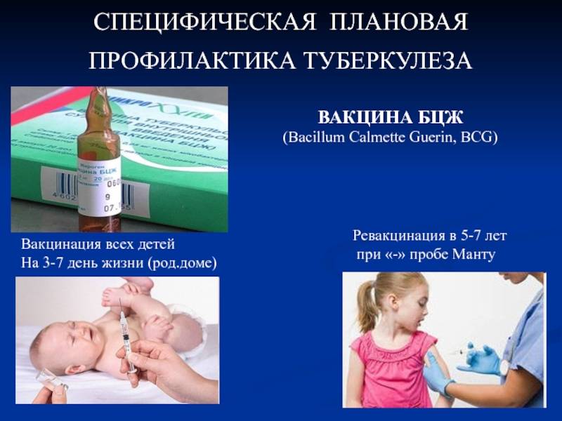 Прививка от туберкулёза: когда делают детям, реакция, вакцины