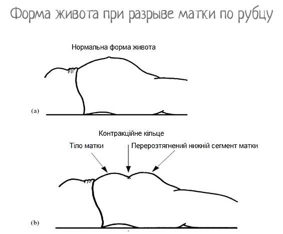 Секс после родов