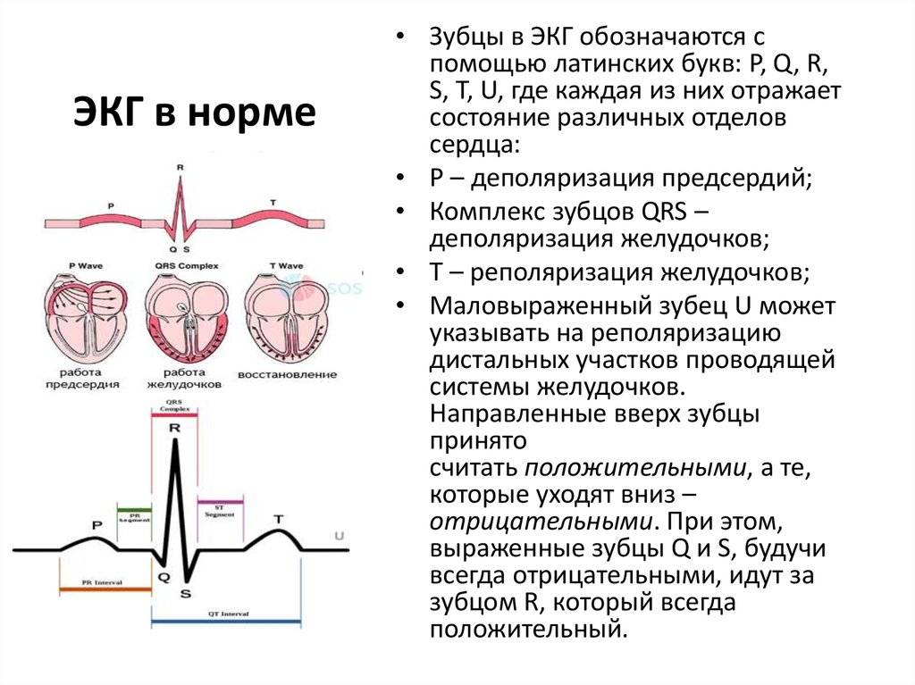 Нарушения процессов реполяризации в миокарде: причины, виды, последствия, и методы лечения