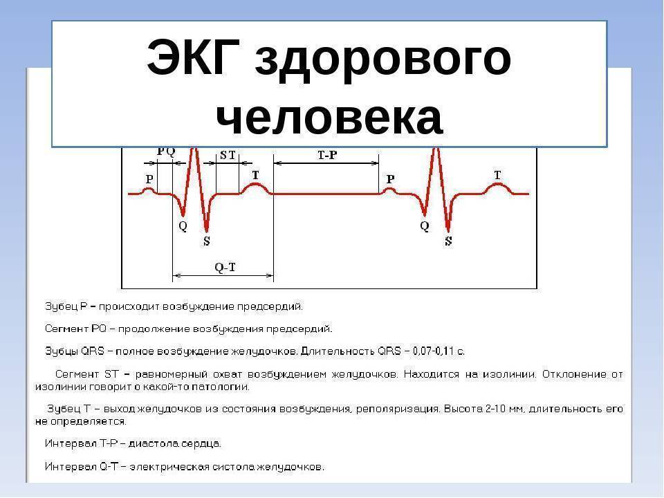 Расшифровка результатов ЭКГ у ребенка: нормы показателей и причины нарушений