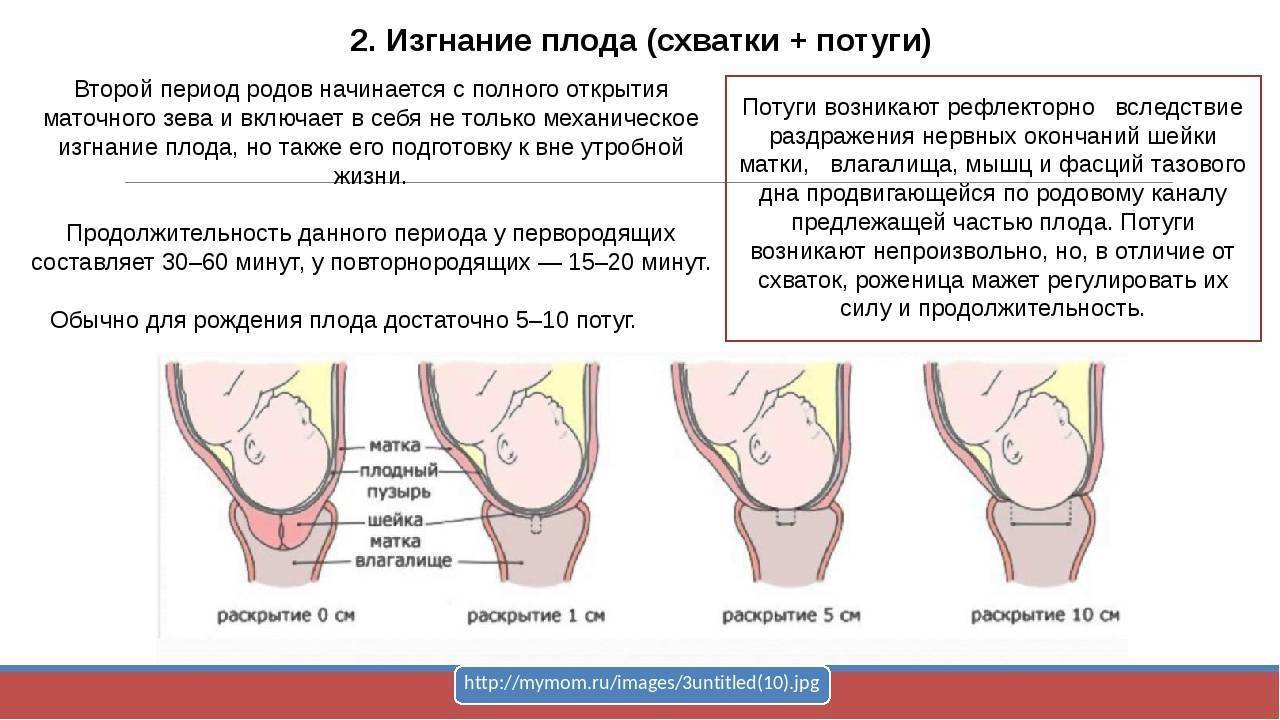 Как вызвать схватки?