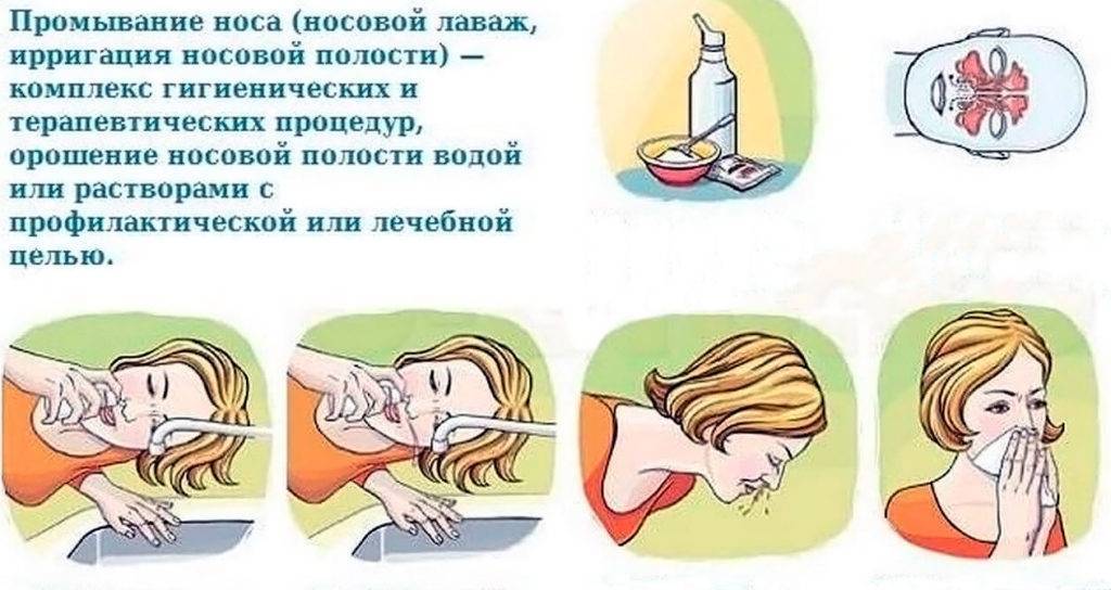 Как и чем промывать нос, как промыть нос детям и взрослым в домашних условиях, как часто делать промывание носа для профилактики