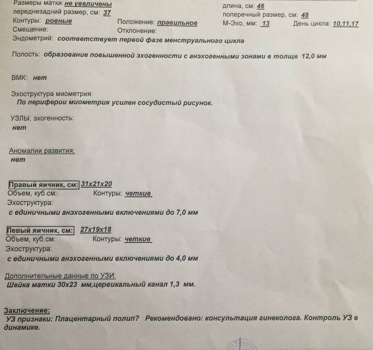Эндометриоз и беременность: возможно ли зачатие