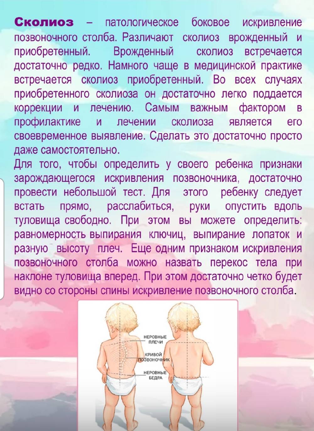 Лечение сколиоза у подростков: что делать, как исправить в домашних условиях, упражнения, причины