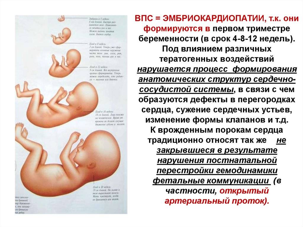 Самые важные вопросы об эхо сердца плода | аборт в спб