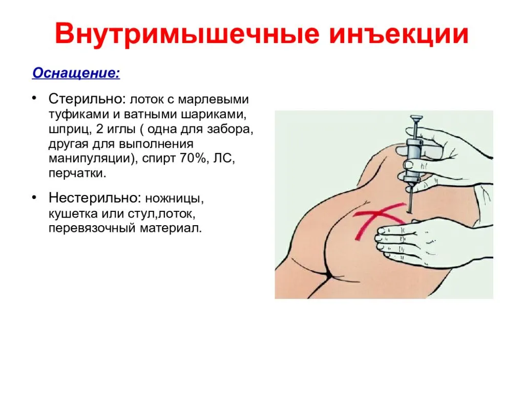 Как сделать укол в ягодицу в 3 шага: инструкция от врача