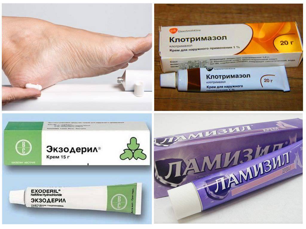 Детские противогрибковые препараты: какие мази, кремы и другие средства рекомендованы малышам до и от 1 года?