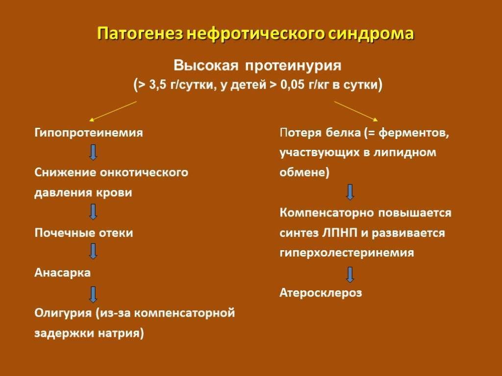 Нефротический синдром у детей