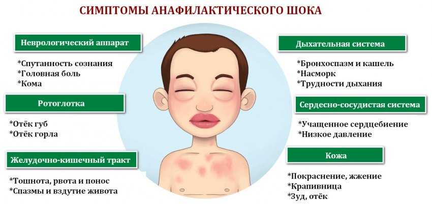 Аллергия на смесь у грудничка: как проявляется и что делать