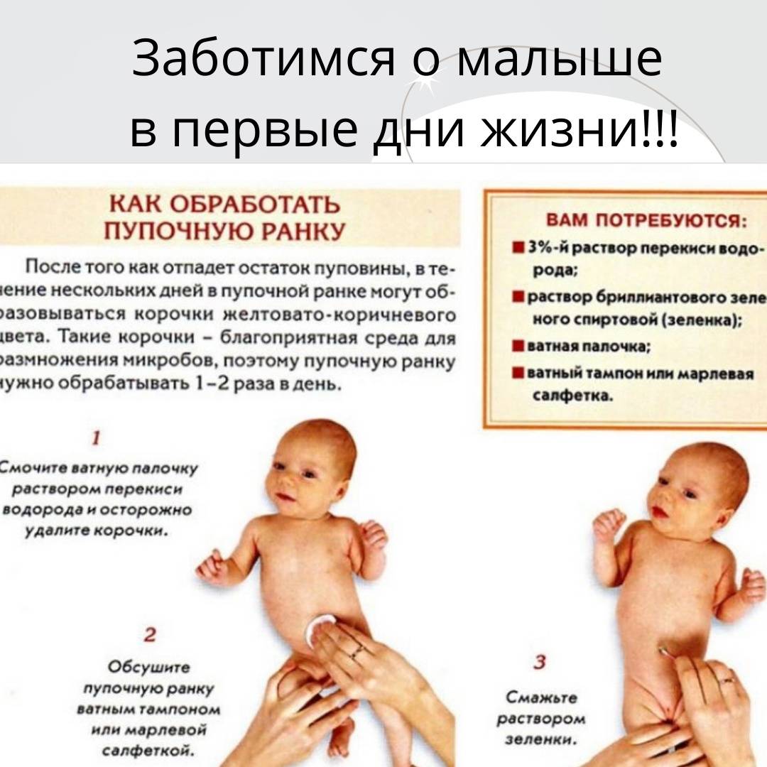 Омфалит у новорожденных: фото гнойной и серозной формы, симптомы, лечение и профилактика