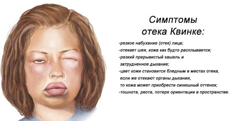 Опухла губа с одной стороны. причины и признаки опухания | здоровье человека