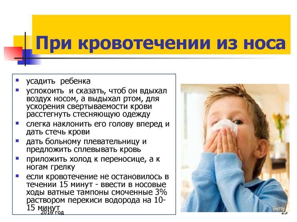 Почему у ребенка из носа идет кровь: причины и лечение носового кровотечения в домашних условиях