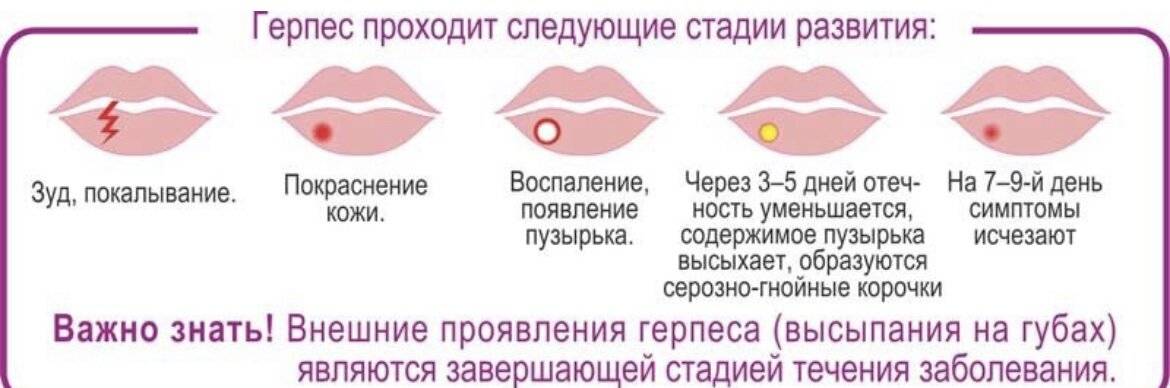 Опухла верхняя губа - причина возникновения недуга у взрослого и ребенка, лечение | merilin-clinic.ru