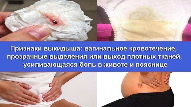 Выскабливание | показания, осложнения, лечение