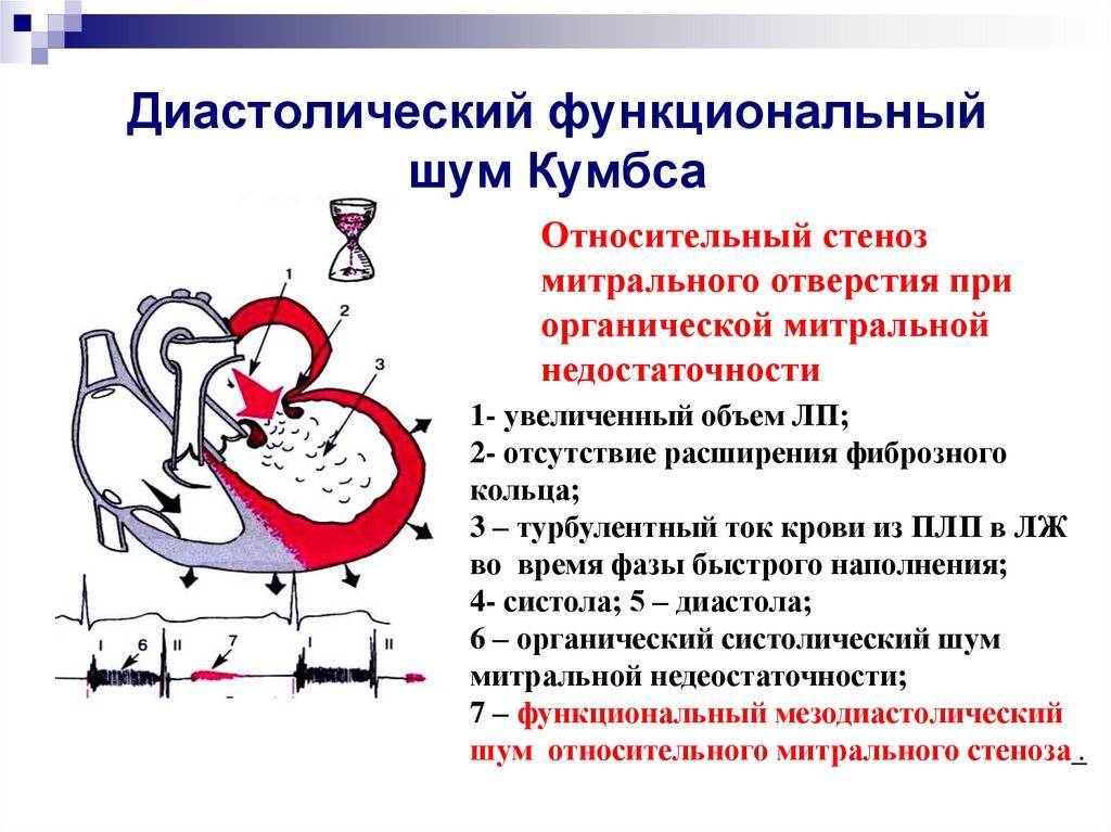 Причины и последствия появления шумов в сердце у новорожденного, как лечить ребенка