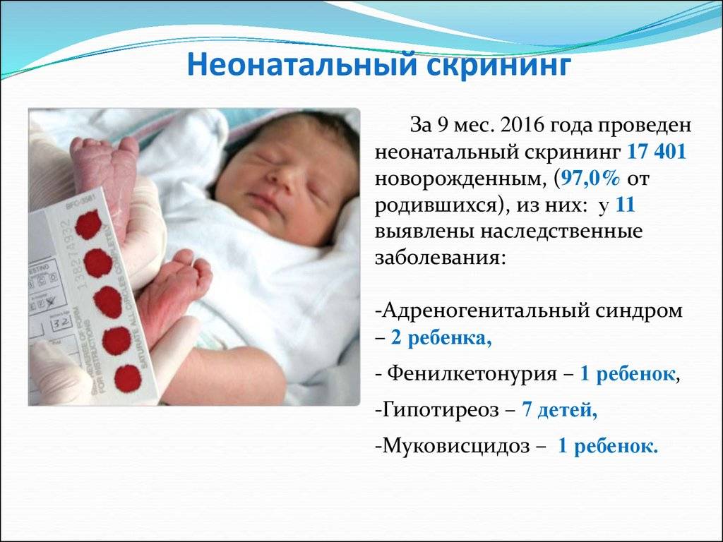 Неонатальный скрининг для новорожденных: важные советы для будущих родителей