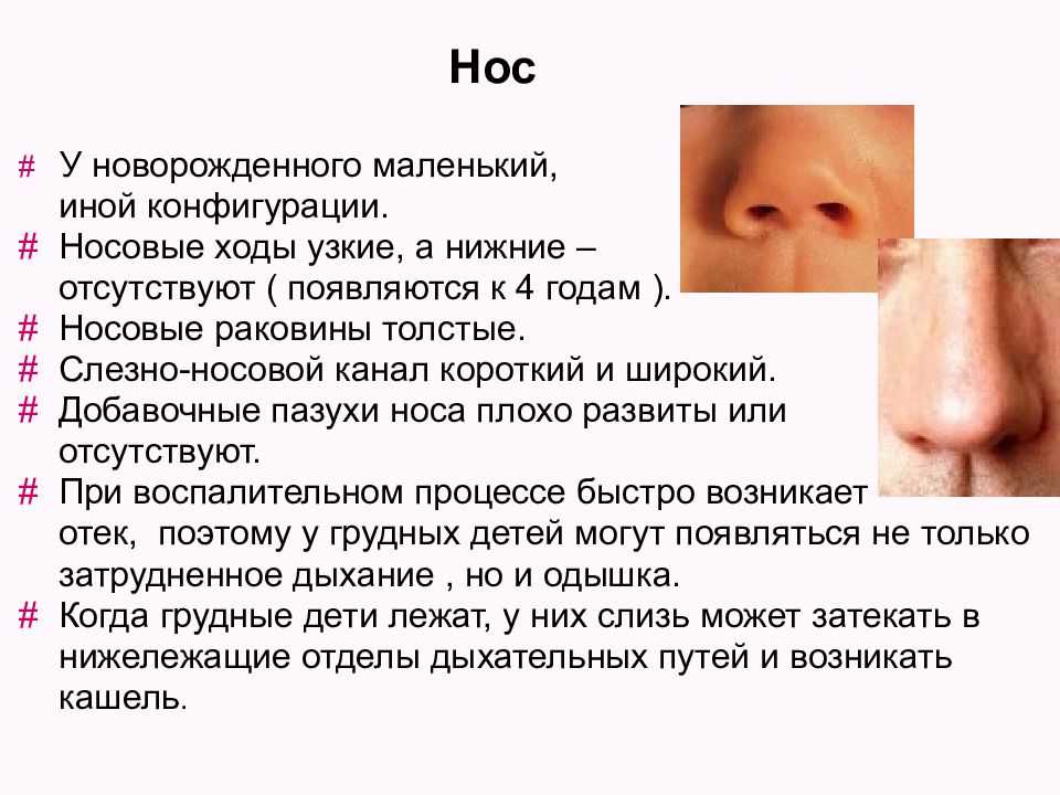 Насморк без соплей у грудничка