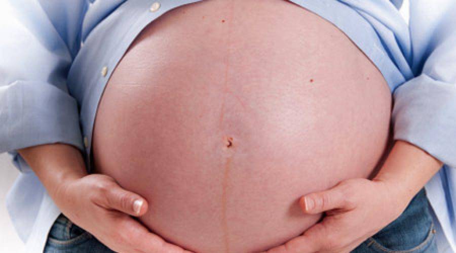 Выделения из пупка с неприятным запахом у женщин (у взрослого, при беременности) – причины крови