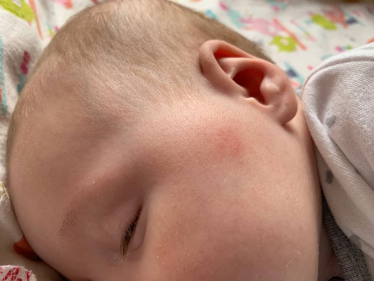 Почему на теле и лице у новорожденного или грудного ребенка появилась сыпь в виде мелких прыщиков: фото с пояснениями